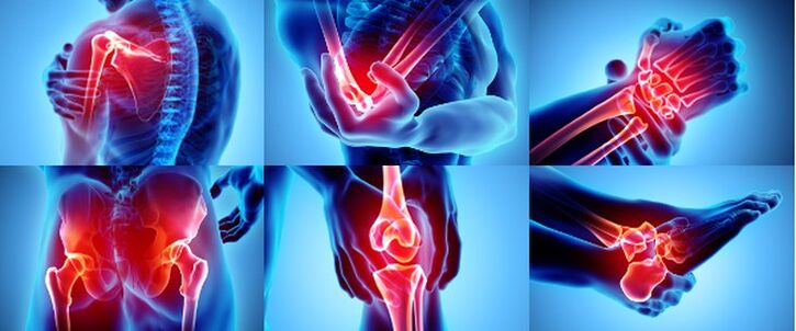 Възпалени стави